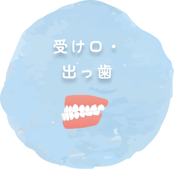 受け口・出っ歯