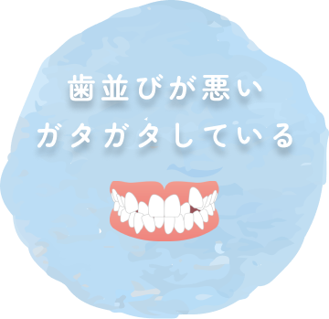 歯並びが悪い・ガタガタしている